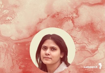 From Noise to Signal: Using MCP Servers for AI-Driven Alerting and Monitoring