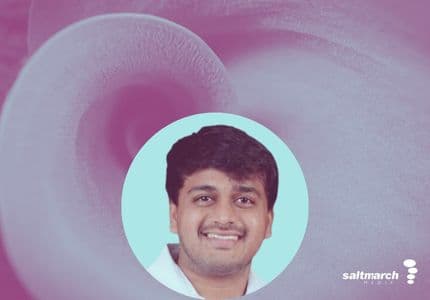 Agent Memory as Core Design: From Pilot to Production