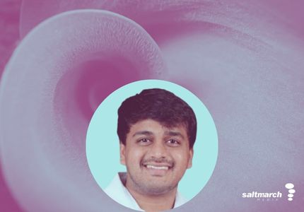 Agent Memory as Core Design: From Pilot to Production